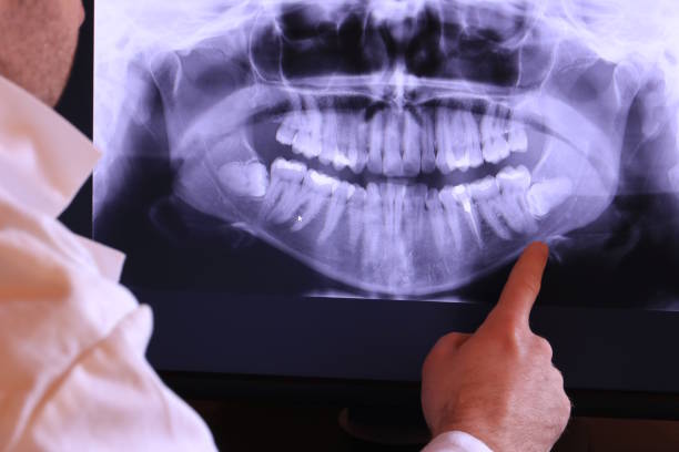 Best Emergency Dentist for Special Needs Patients in Weston, NJ