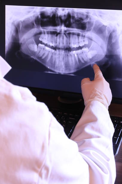 Best Emergency Dental Care for Abscessed Tooth in Weston, NJ